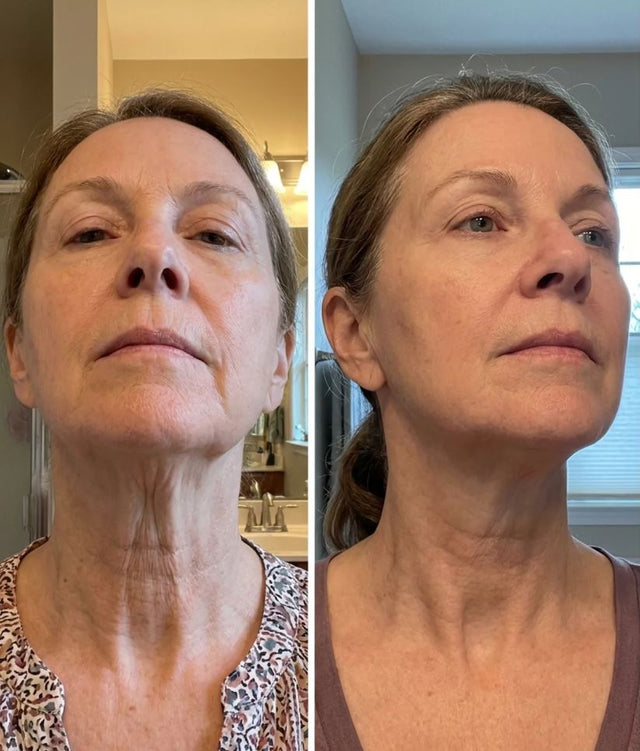 Constance M., 61 before and after