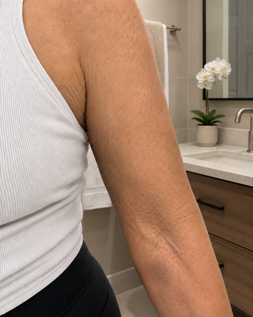 Arms · 12 weeks after