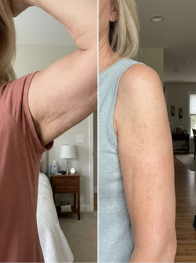 Adele P., 58 before and after