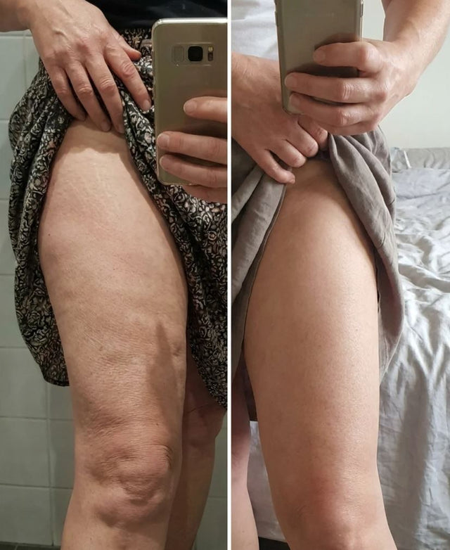 Faye S., 60 before and after