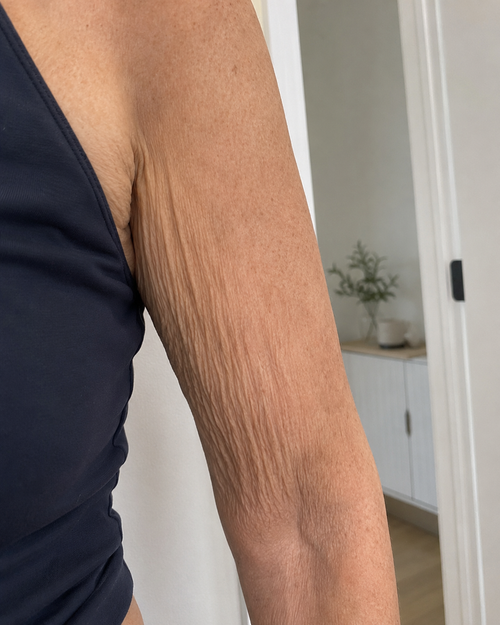 Arms · 12 weeks before