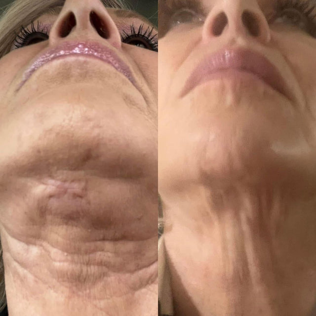 Marguerite D., 59 before and after