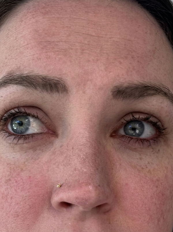 Before — Diane R.