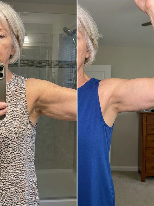 Harriet E., 65 before and after